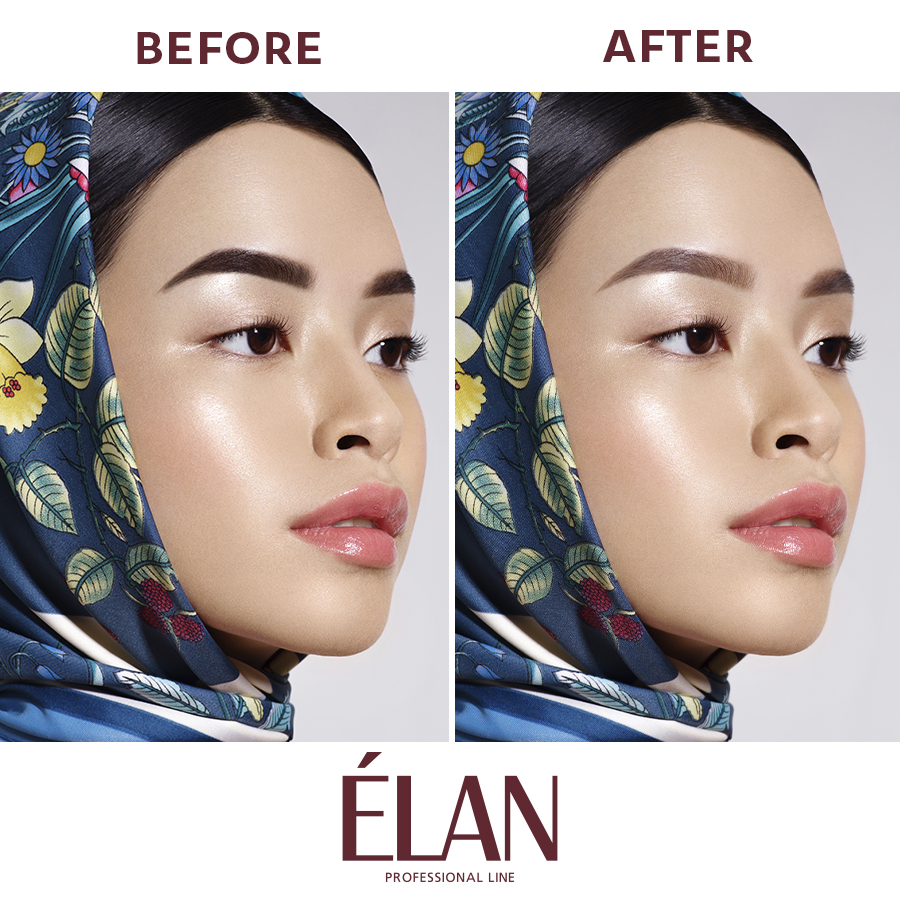 Expert System pentru înlăturarea pigmentului artificial "Brow D-Color 2.0" Step 1